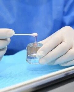 Fluoride Northampton
