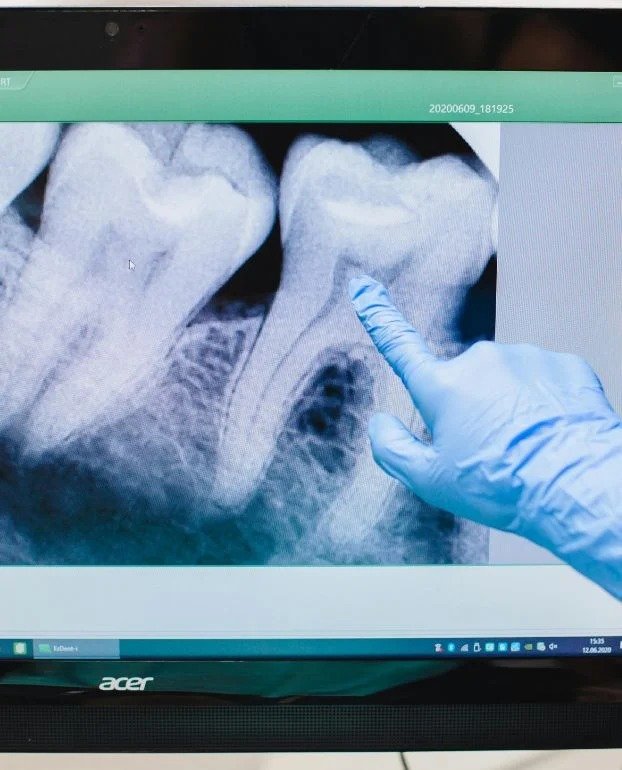 Oral Cancer Screening in Northampton