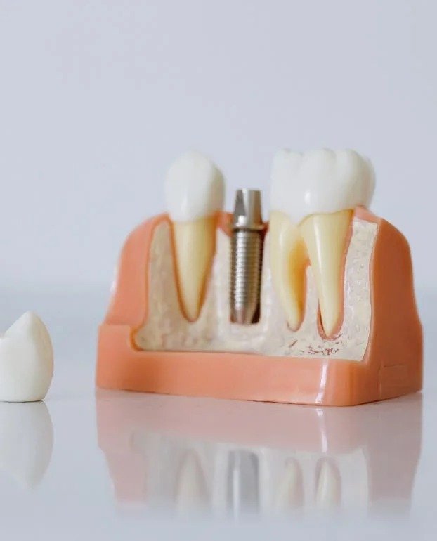 Periodontal Therapy Northampton