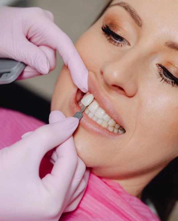 Porcelain Crowns in Northampton