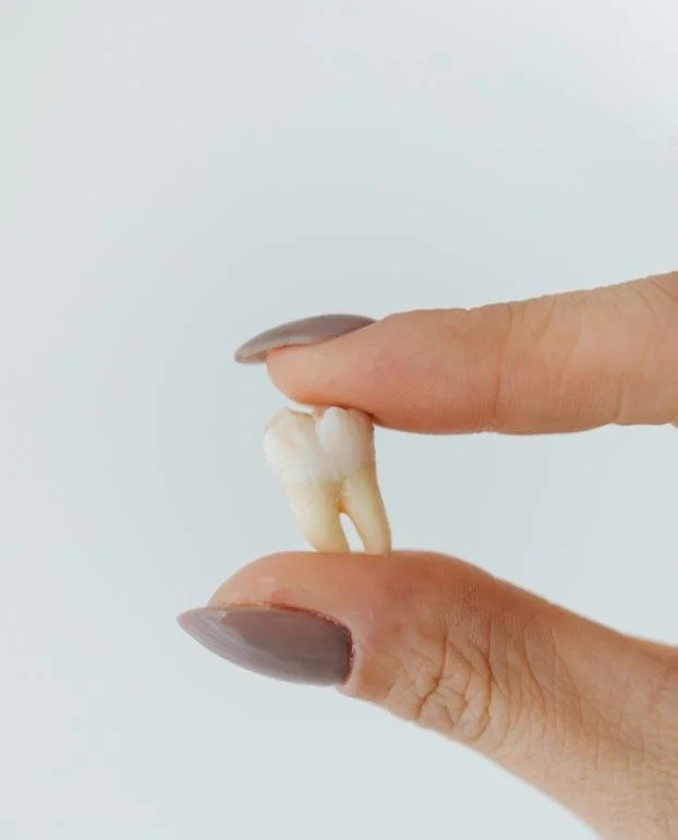 Tooth Extraction in Northampton