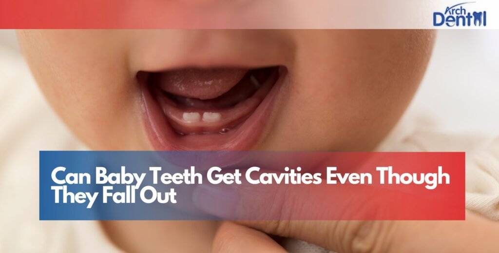 Can Baby Teeth Get Cavities Even Though They Fall Out