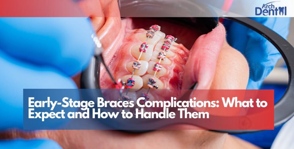 Early-Stage Braces Complications