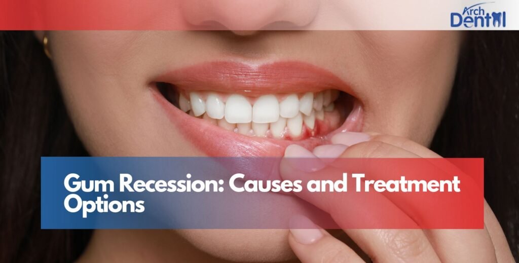 Gum Recession: Causes and Treatment Options