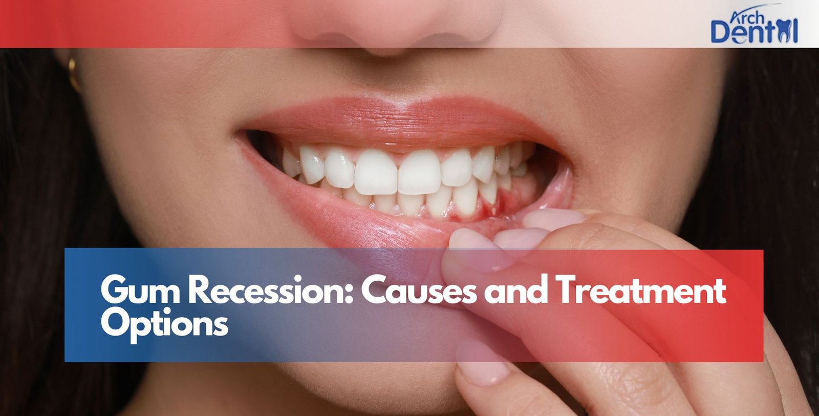 Gum Recession: Causes and Treatment Options