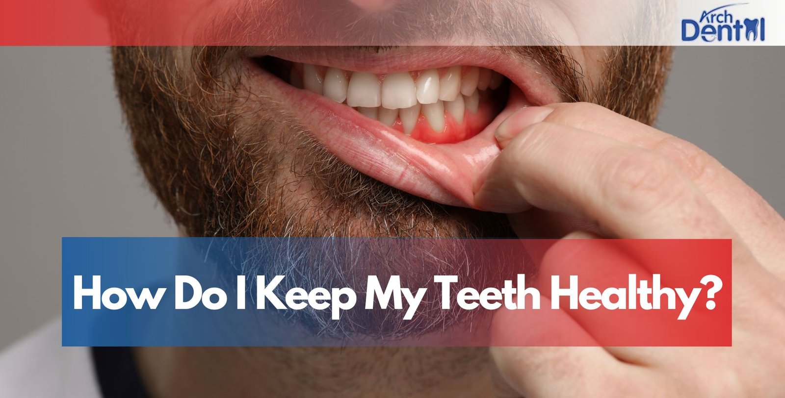 How Do I Keep My Teeth Healthy