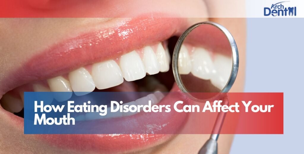How Eating Disorders Can Affect Your Mouth