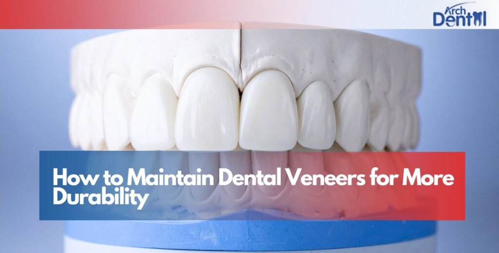 How to Maintain Dental Veneers for More Durability