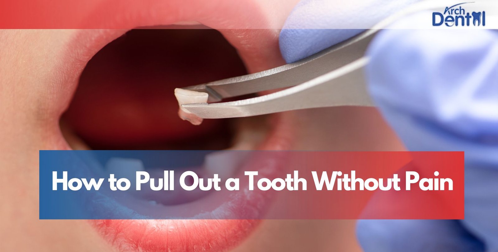 How to Pull Out a Tooth Without Pain