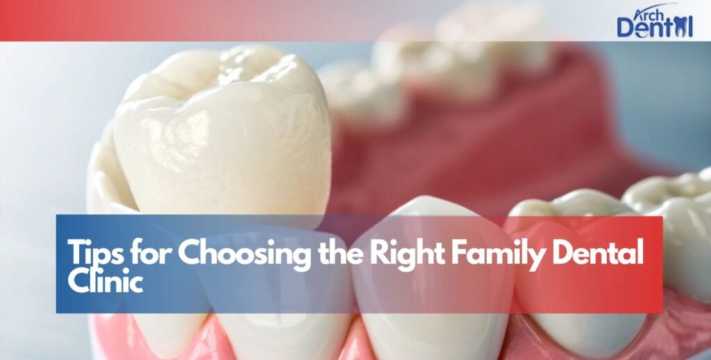 Tips for Choosing the Right Family Dental Clinic