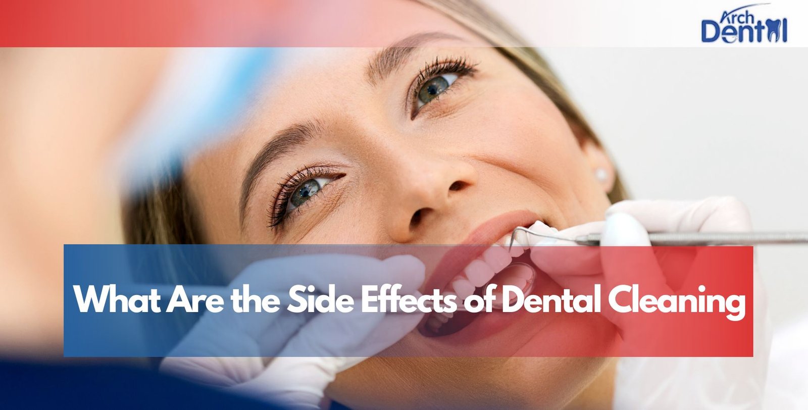 What Are the Side Effects of Dental Cleaning