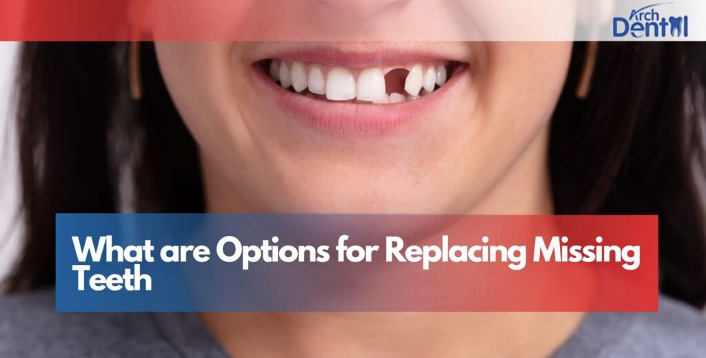 What are Options for Replacing Missing Teeth