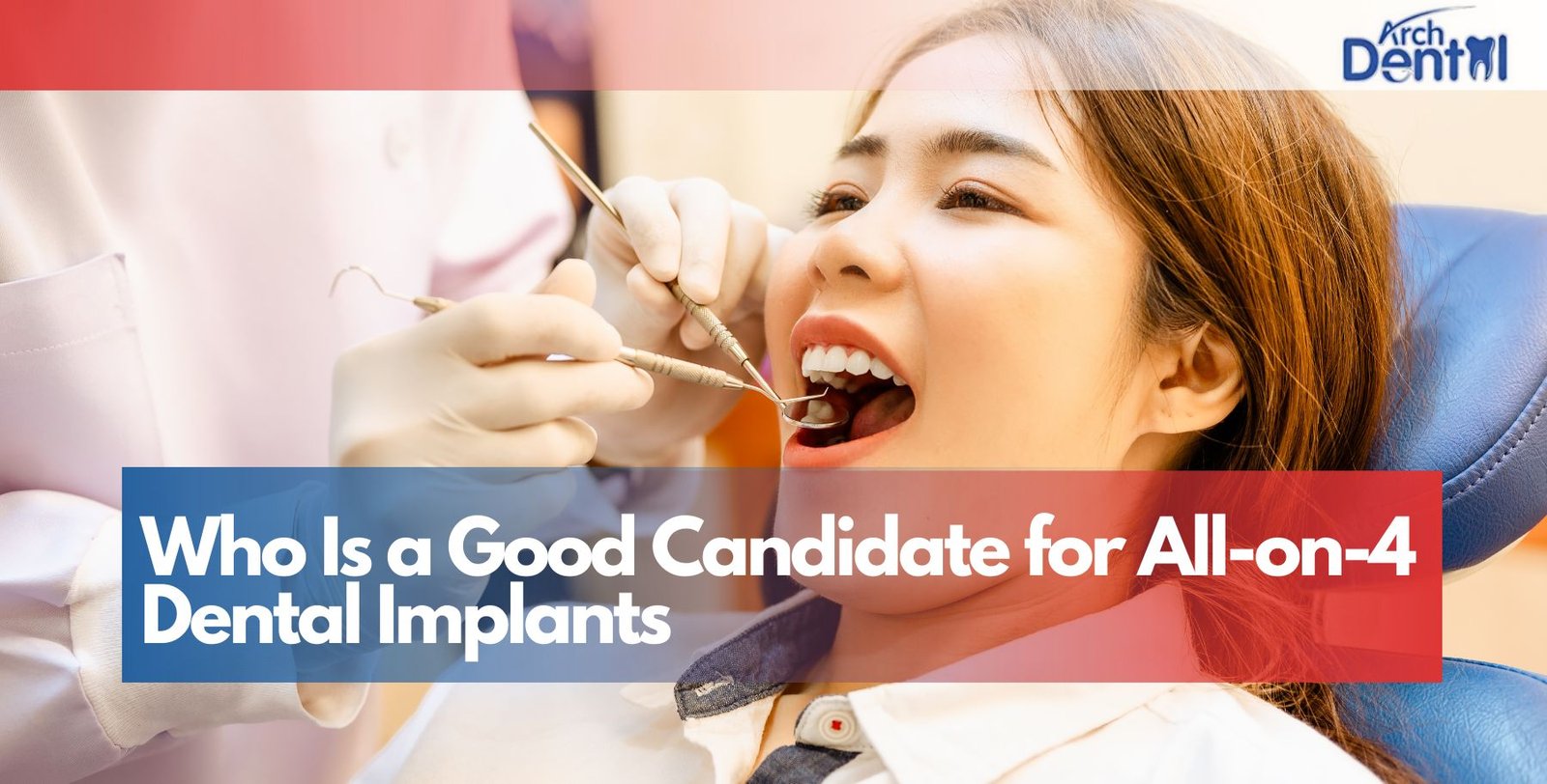 Who Is a Good Candidate for All-on-4 Dental Implants
