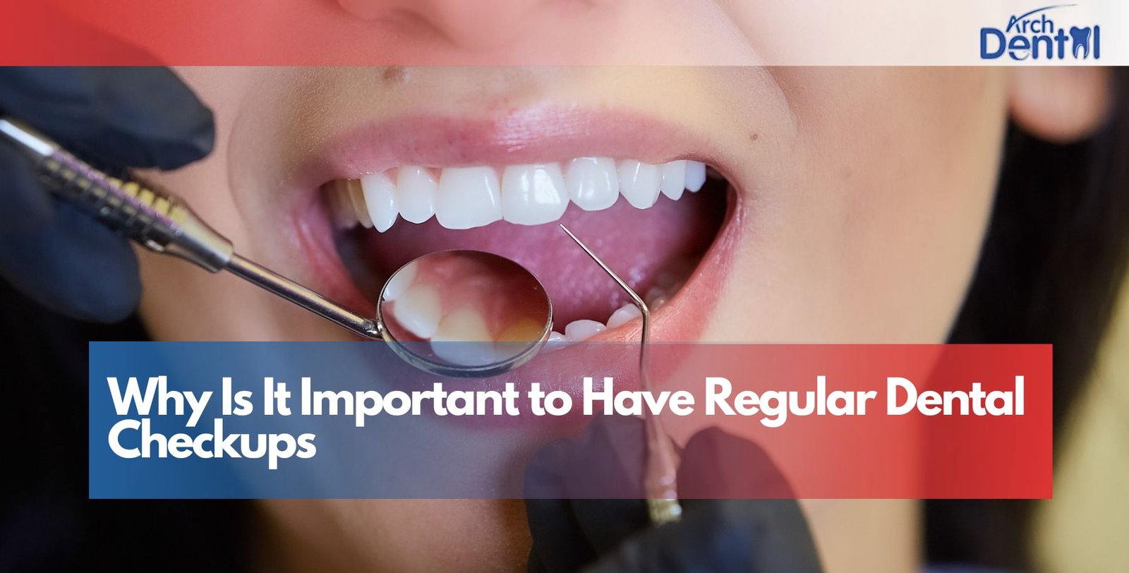 Why Is It Important to Have Regular Dental Checkups