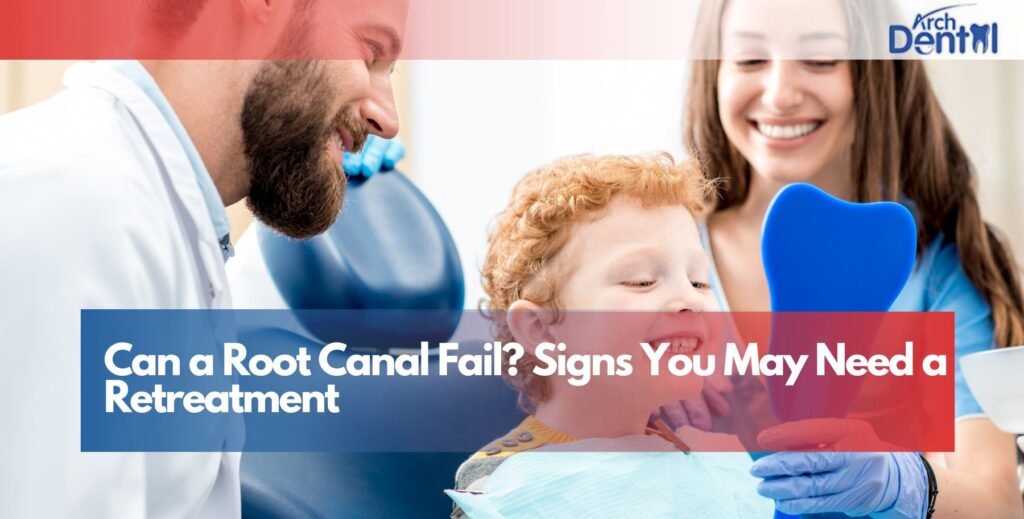 Can a Root Canal Fail? Signs You May Need a Retreatment
