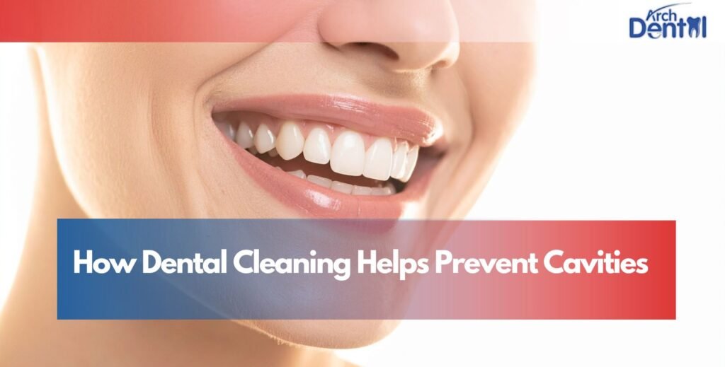 How Dental Cleaning Helps Prevent Cavities