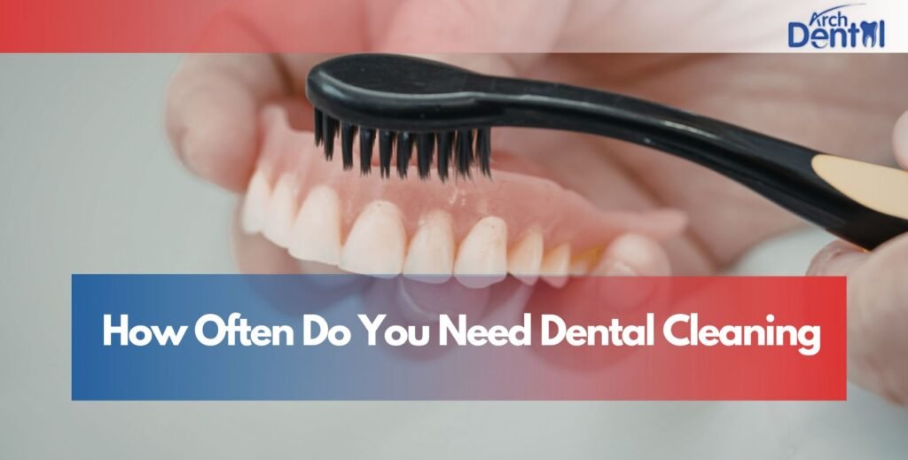How Often Do You Need Dental Cleaning