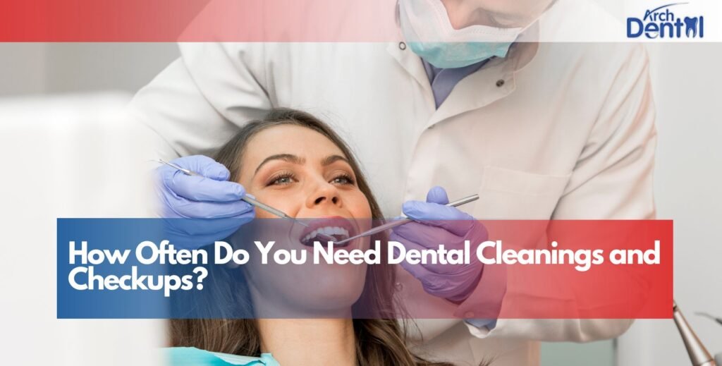 How Often Do You Need Dental Cleanings and Checkups