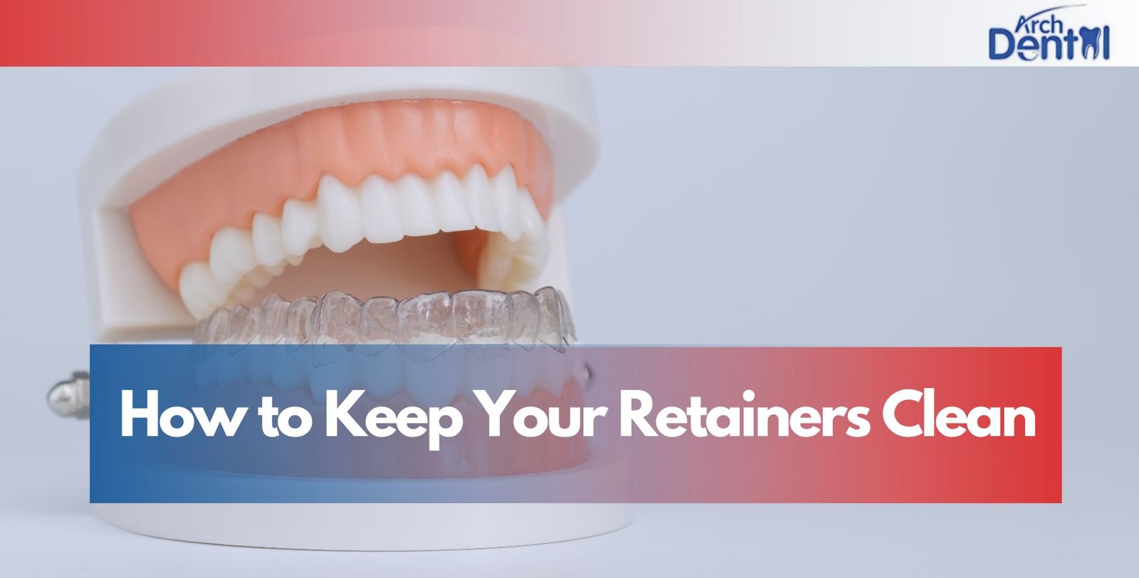 How to Keep Your Retainers Clean