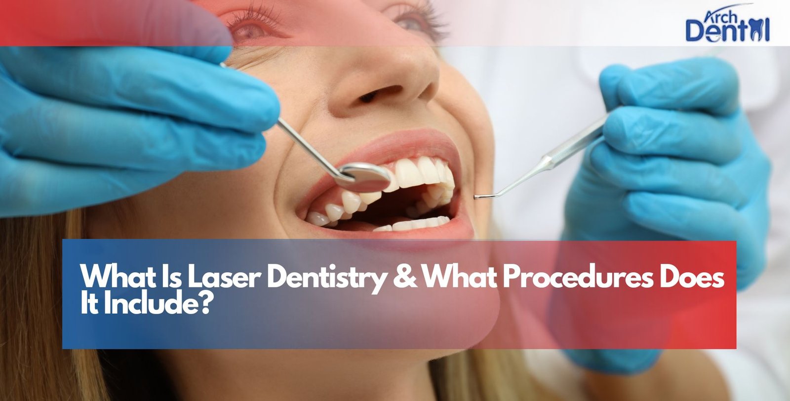 What Is Laser Dentistry & What Procedures Does It Include