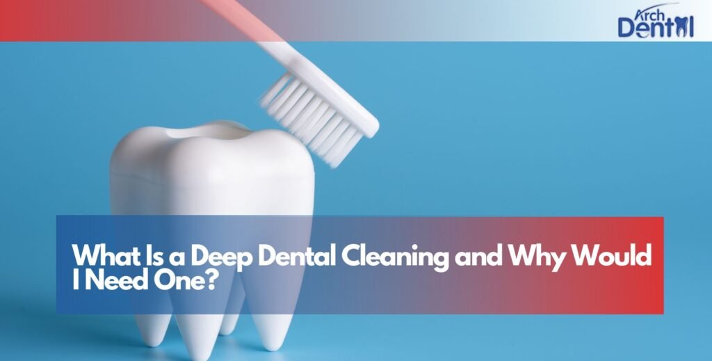 What Is a Deep Dental Cleaning and Why Would I Need One