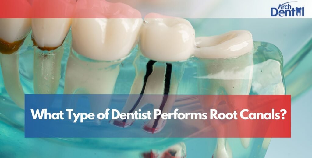 What Type of Dentist Performs Root Canals