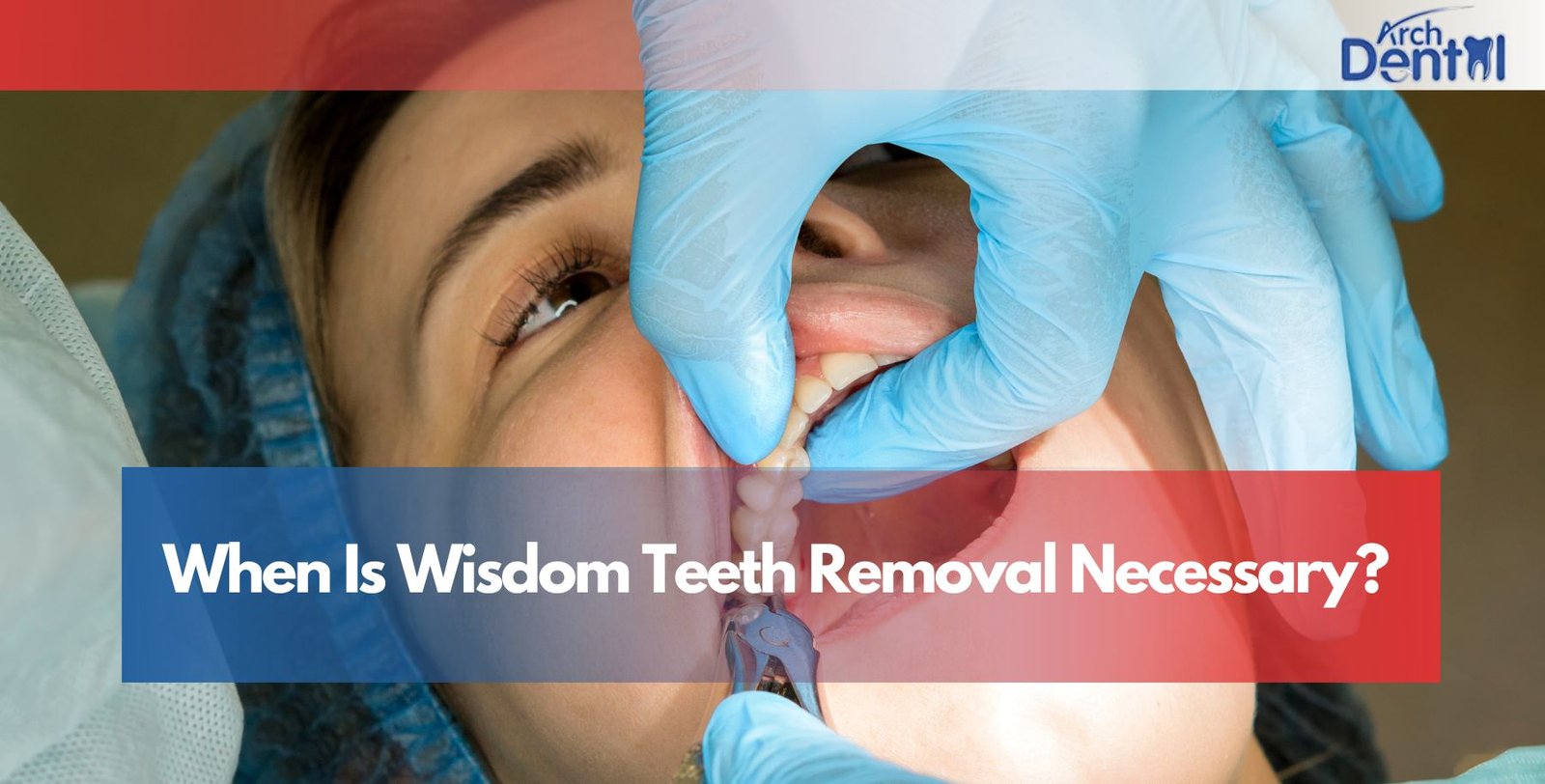 When Is Wisdom Teeth Removal Necessary