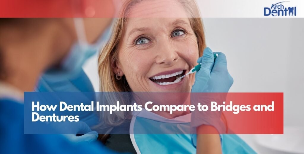 How Dental Implants Compare to Bridges and Dentures