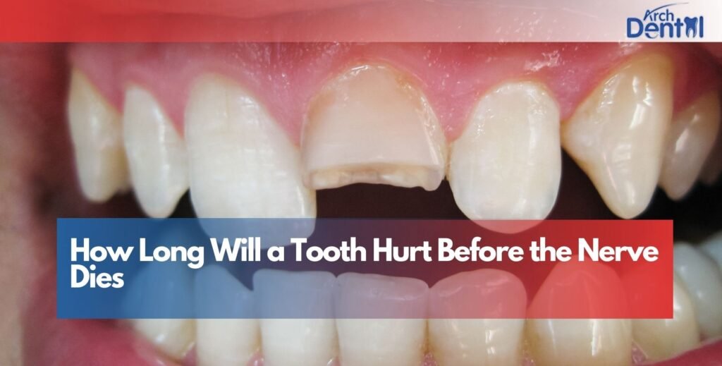 How Long Will a Tooth Hurt Before the Nerve Dies