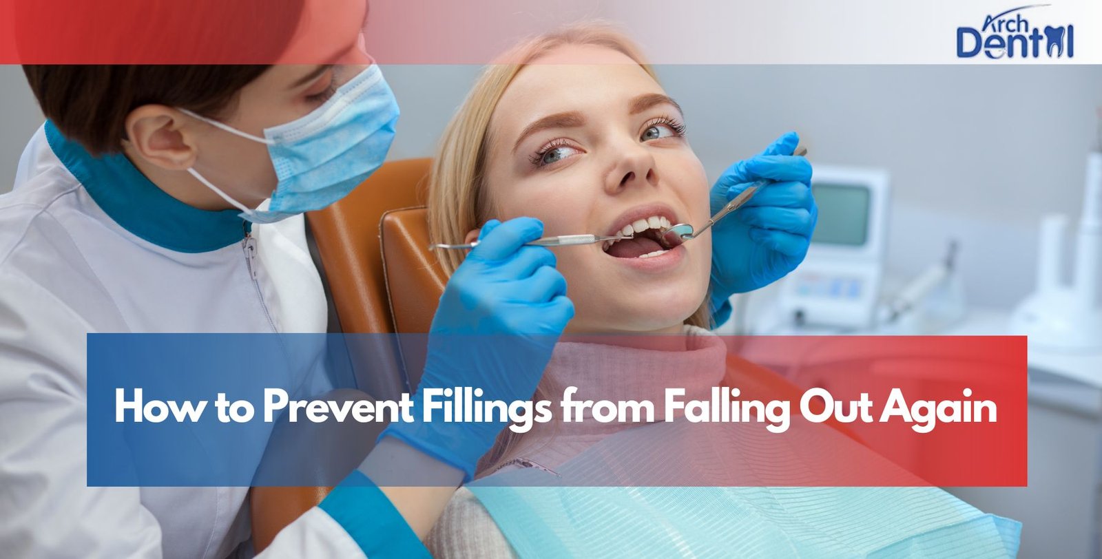 How to Prevent Fillings from Falling Out Again
