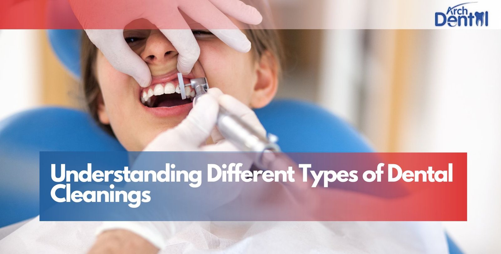 Understanding Different Types of Dental Cleanings