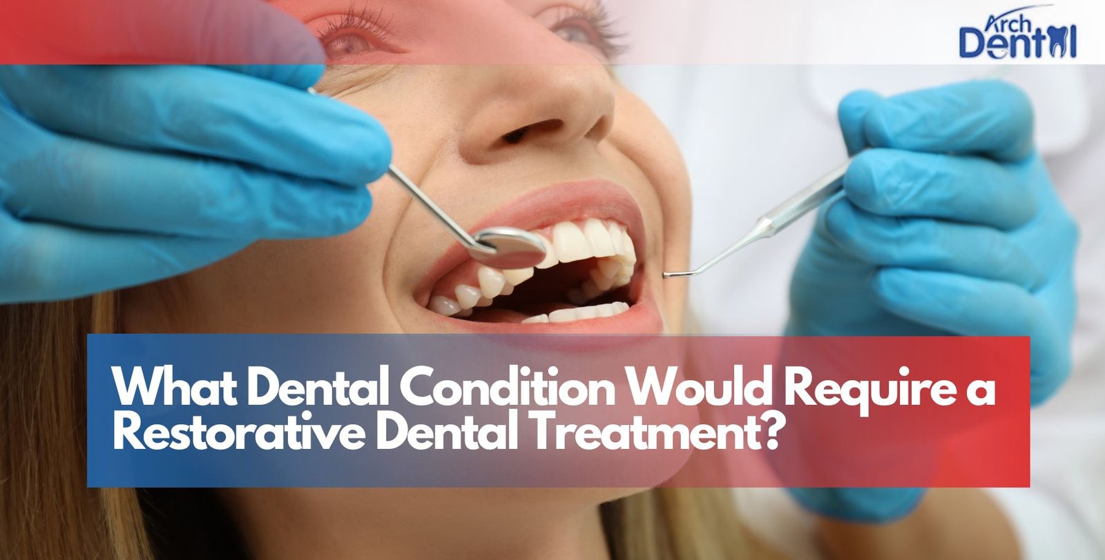 What Dental Condition Would Require a Restorative Dental Treatment